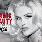 How did Anna Nicole Smith die cause of death age of death